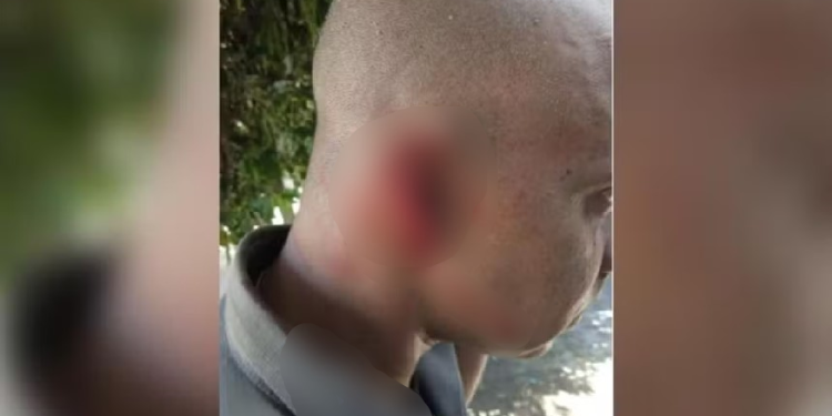 PM tem parte da orelha arrancada por homem bêbado durante abordagem