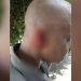 PM tem parte da orelha arrancada por homem bêbado durante abordagem
