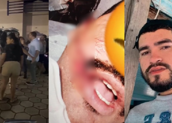 Homem é procurado após rasgar a boca de soldado da PM durante prisão no interior do AM