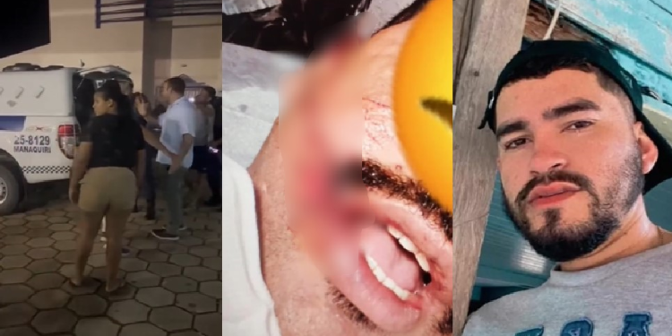 Homem é procurado após rasgar a boca de soldado da PM durante prisão no interior do AM