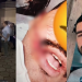 Homem é procurado após rasgar a boca de soldado da PM durante prisão no interior do AM