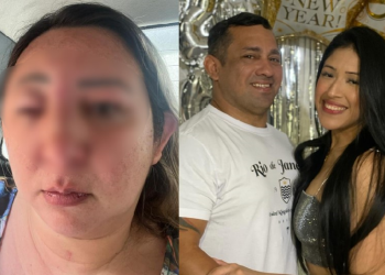 Vídeos: Mulher diz que foi espancada por candidata do ‘Musa do Busão’ incentivada pelo ex-companheiro