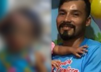 Garotinha agredida em Manaus pelo pai passa por cirurgia; veja como ficou cabeça