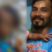 Garotinha agredida em Manaus pelo pai passa por cirurgia; veja como ficou cabeça