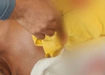 Terror no Purus: Pescador tem o braço quase arrancado por jacaré na frente do filho de 10 anos