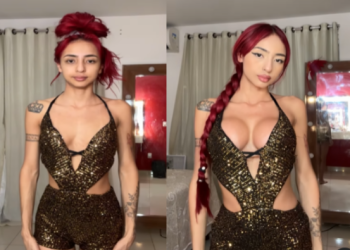 Ruivinha de Marte faz antes e depois do silicone e recebe perguntas indiscretas: ‘Já fez espanhola?’