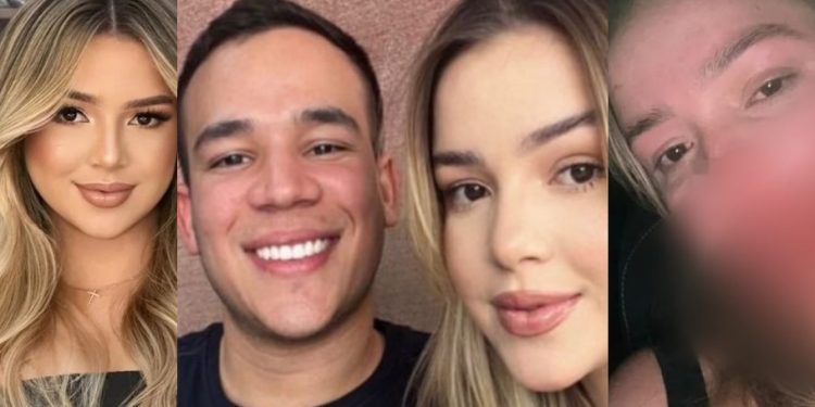 Namorada de empresário tem rosto quebrado por síndico após reclamação; veja fotos