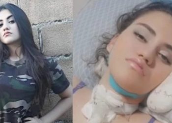 Jovem fica cega, em coma e não consegue mais falar, após contrair dengue