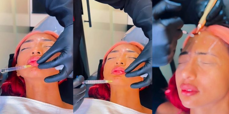 Vídeo: Ruivinha de Marte entope boca, queixo e nariz de botox: ‘vou mudar até o DNA’