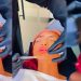 Vídeo: Ruivinha de Marte entope boca, queixo e nariz de botox: ‘vou mudar até o DNA’