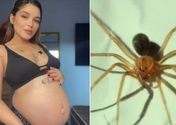 Grávida fica com perna necrosada após levar picada de aranha; foto