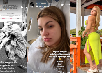 Caila Carim diz que marido não ‘socou fofo’ e precisou de cirurgia após noitada: ‘Eu gosto de d*r’