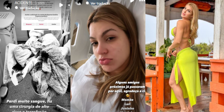 Caila Carim diz que marido não ‘socou fofo’ e precisou de cirurgia após noitada: ‘Eu gosto de d*r’