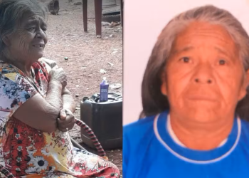 Idosa morre após descobrir que tinha um feto há 56 anos dentro do próprio útero