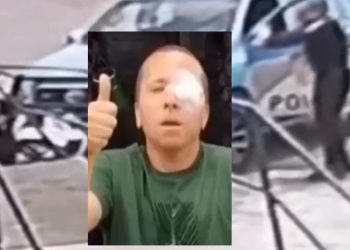 Vídeo: policial baleado no olho mata criminoso e vai dirigindo viatura para o hospital