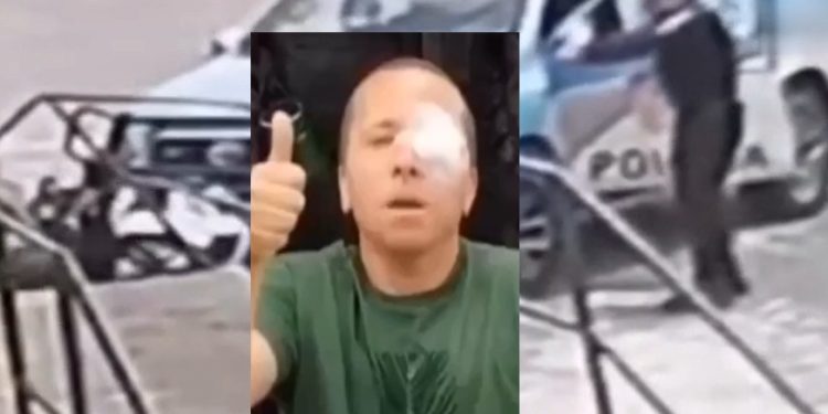 Vídeo: policial baleado no olho mata criminoso e vai dirigindo viatura para o hospital