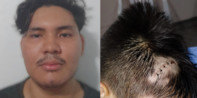 Professor de Muay Thai é denunciado por enforcar menino de 11 anos em Manaus e ‘abrir’ cabeça dele