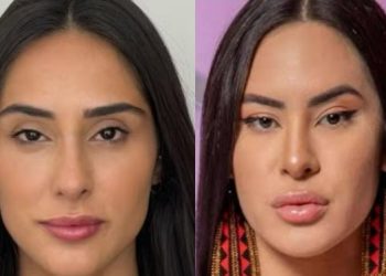 Deniziane faz harmonização facial e vira a genérica da Isabelle Nogueira