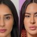Deniziane faz harmonização facial e vira a genérica da Isabelle Nogueira