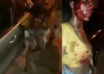 Mulher é espancada por membros de facç@0 e proibida de ir ao hospital