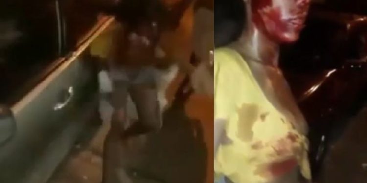 Mulher é espancada por membros de facç@0 e proibida de ir ao hospital