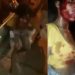Mulher é espancada por membros de facç@0 e proibida de ir ao hospital