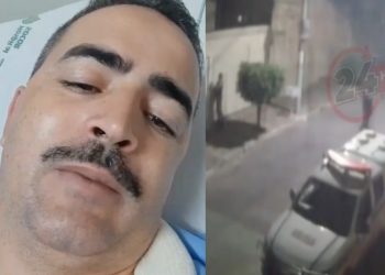 Vídeo forte: policial mostra braço rasgado por tiro de bandido: ‘munição quebrou um dos ossos’
