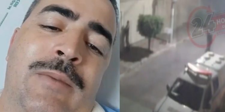 Vídeo forte: policial mostra braço rasgado por tiro de bandido: ‘munição quebrou um dos ossos’