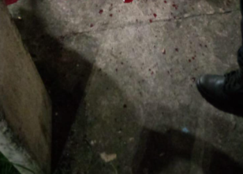 Cena forte: Homem é assassinado com balaço no meio da cabeça no bairro Lago Azul