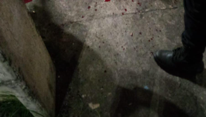 Cena forte: Homem é assassinado com balaço no meio da cabeça no bairro Lago Azul