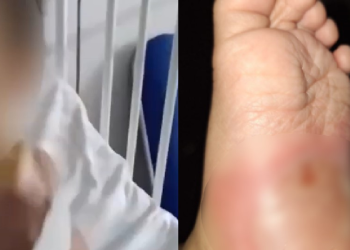 Vídeo: Menino de 1 ano é queimado e tem clavícula quebrada pela madrasta e o pai em Manaus