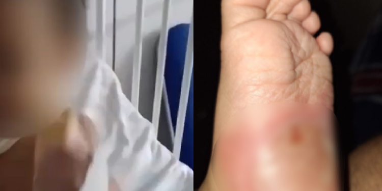 Vídeo: Menino de 1 ano é queimado e tem clavícula quebrada pela madrasta e o pai em Manaus