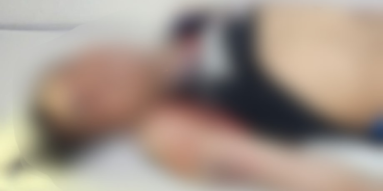 Polícia salva jovem no ‘bico do urubu’ após ele ser espancado por mais de 20 na Compensa