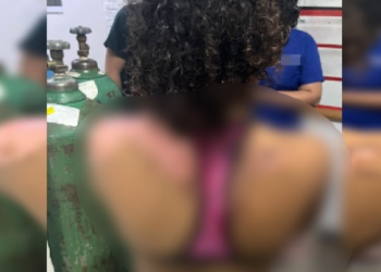 Vídeo: Mulher que jogou água fervendo na sobrinha de 13 anos por ciúmes do marido é presa