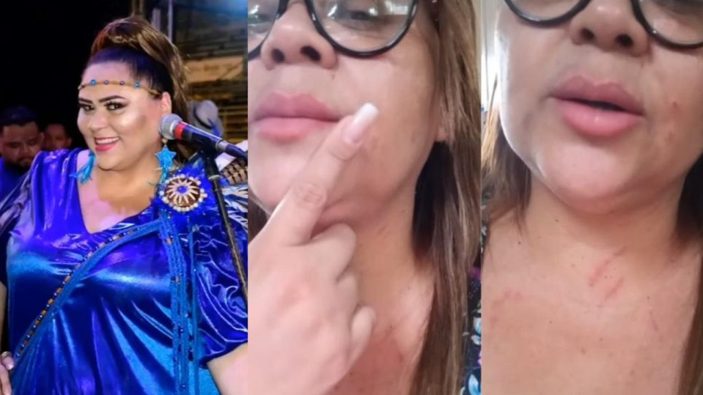 Cantora do Caprichoso relata agressão por usar blusa do bumbá em estacionamento: “peguei um soco no nariz"