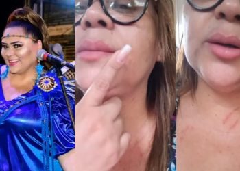 Cantora do Caprichoso relata agressão por usar blusa do bumbá em estacionamento: “peguei um soco no nariz"