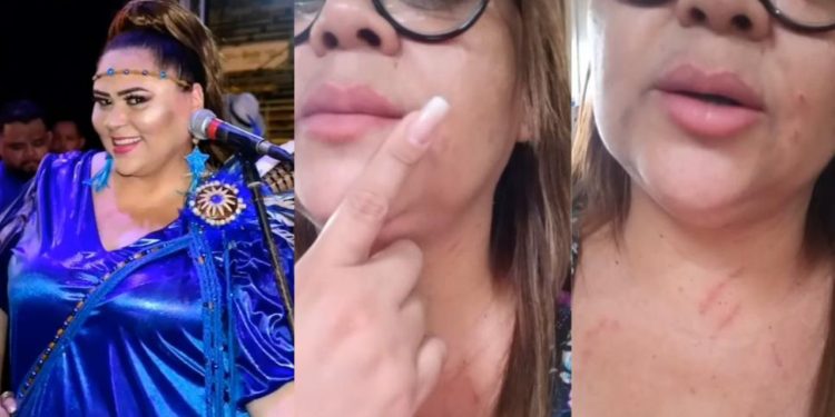 Cantora do Caprichoso relata agressão por usar blusa do bumbá em estacionamento: “peguei um soco no nariz"