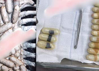 Mulher é deixada em hospital de Manaus com o estômago cheio de drogas