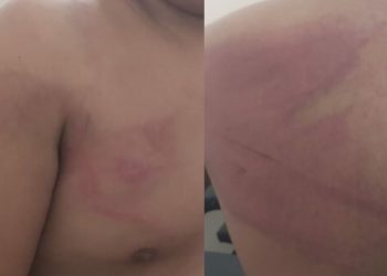 Homem é hospitalizado após ser torturado por 'piratas do rio' no Amazonas