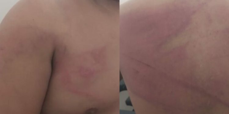 Homem é hospitalizado após ser torturado por 'piratas do rio' no Amazonas