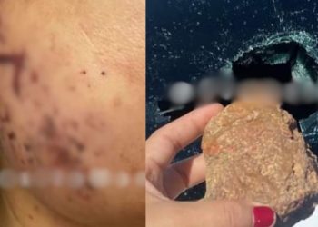 "A pedra pegou no rosto da minha irmã", relata motorista de Manaus que foi atacada na estrada do Rapidão