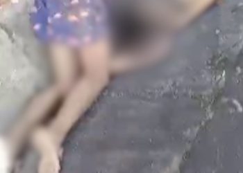 Jovem tem coluna quebrada após ser atropelado na BR-174 de madrugada