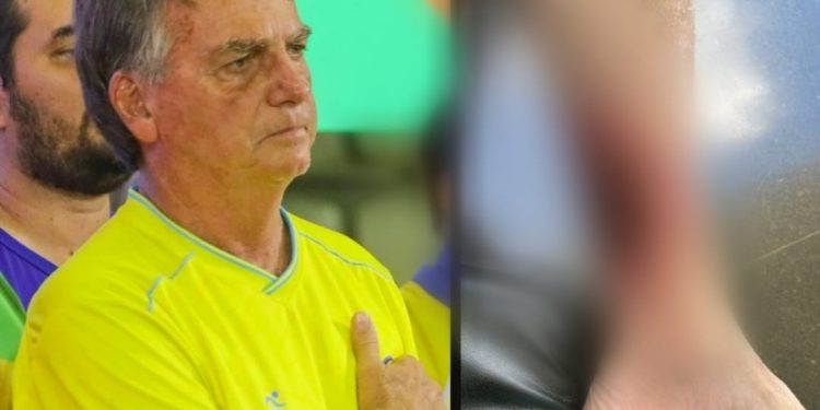 Bactéria na perna mandou Bolsonaro para a Santa Júlia em Manaus