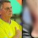 Bactéria na perna mandou Bolsonaro para a Santa Júlia em Manaus