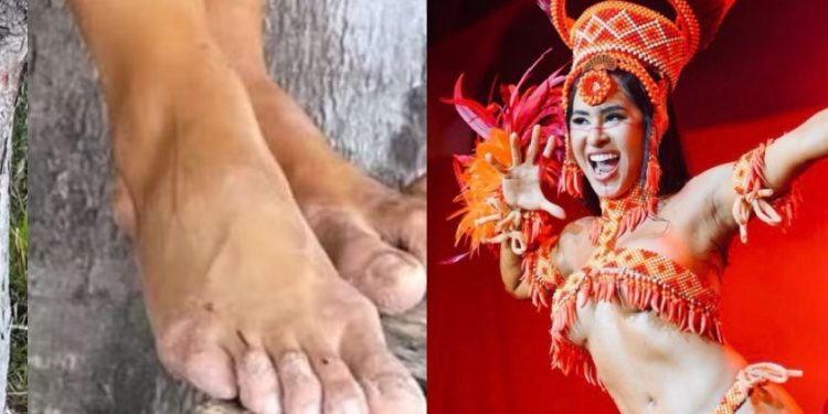 Pés de Isabelle viram piada na rede social: ‘tadinha da minha bichinha’