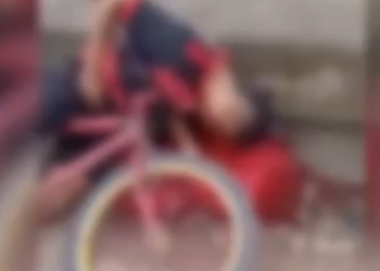 Vídeo: Rapaz é baleado com vários tiros na mandíbula andando de bicicleta