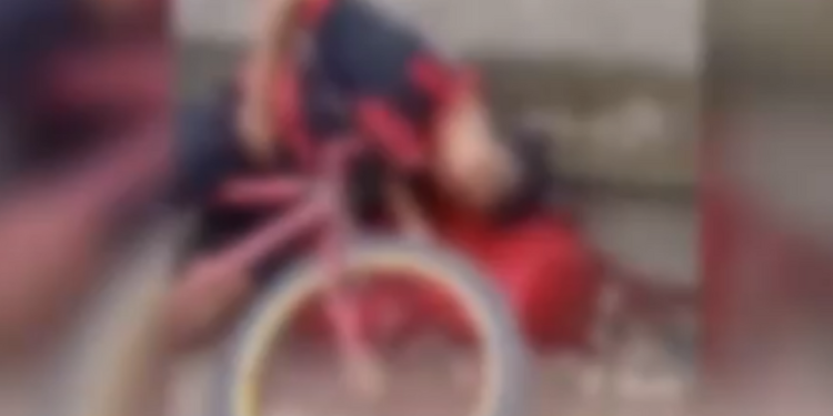 Vídeo: Rapaz é baleado com vários tiros na mandíbula andando de bicicleta
