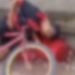Vídeo: Rapaz é baleado com vários tiros na mandíbula andando de bicicleta
