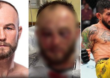 Polonês mostra nas redes sociais como ficou ‘amassado’ ao perder no UFC para amazonense; veja