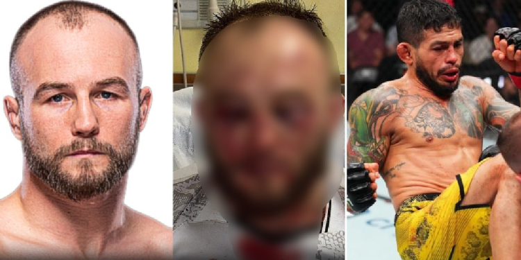 Polonês mostra nas redes sociais como ficou ‘amassado’ ao perder no UFC para amazonense; veja
